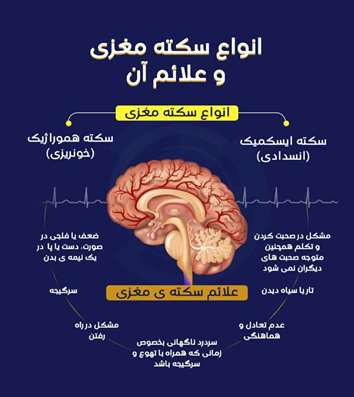 انواع سکته مغزی و علائم آن را بهتر بشناسیم